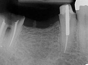 Van Dental Clinic Dental Implant Imaging